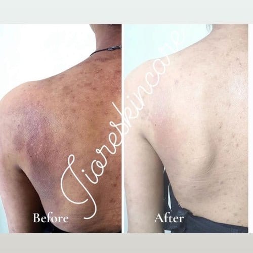 Glowroxy™ Kojic Body Soap (Pack of 3)